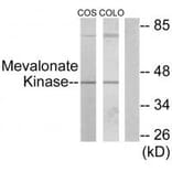 Western blot - Mevalonate Kinase Antibody from Signalway Antibody (33852) - Antibodies.com