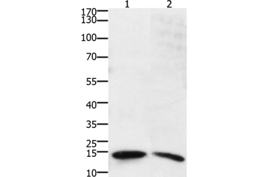 SUMO2/SUMO3/SUMO4 Antibody from Signalway Antibody (36877) - Antibodies.com