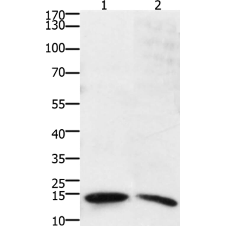 SUMO2/SUMO3/SUMO4 Antibody from Signalway Antibody (36877) - Antibodies.com
