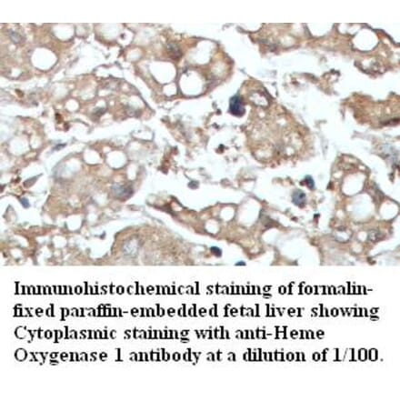 Heme oxygenase 1 Antibody from Signalway Antibody (39422) - Antibodies.com