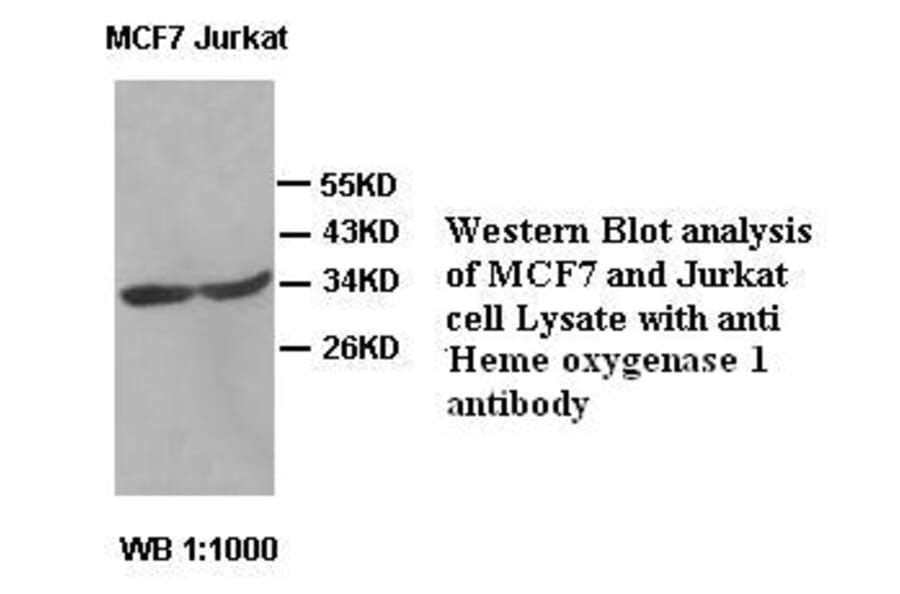 Heme oxygenase 1 Antibody from Signalway Antibody (39422) - Antibodies.com