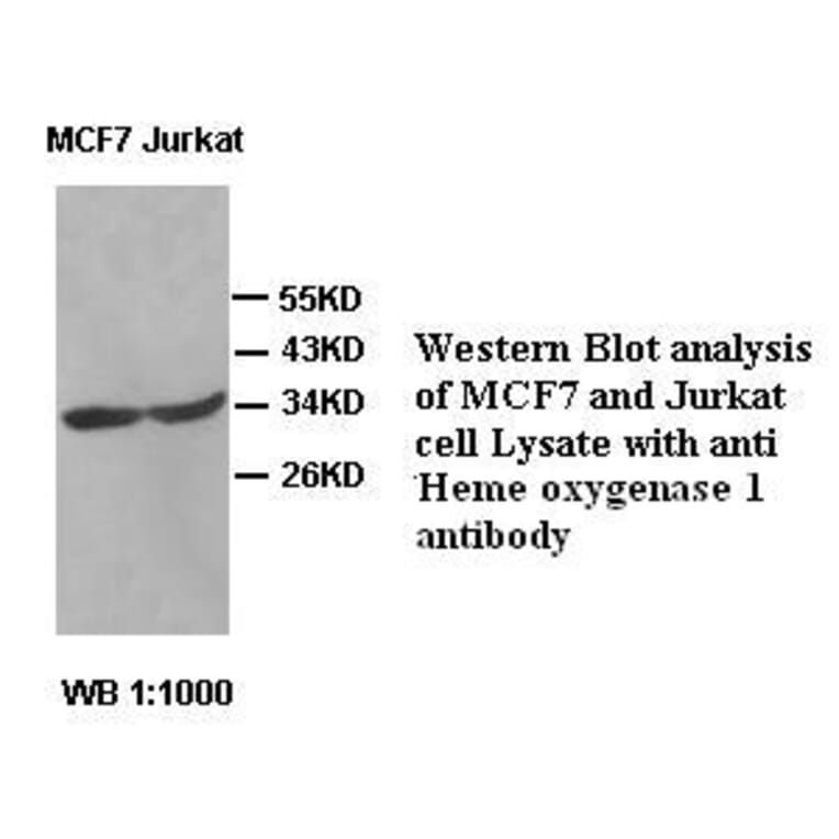 Heme oxygenase 1 Antibody from Signalway Antibody (39422) - Antibodies.com