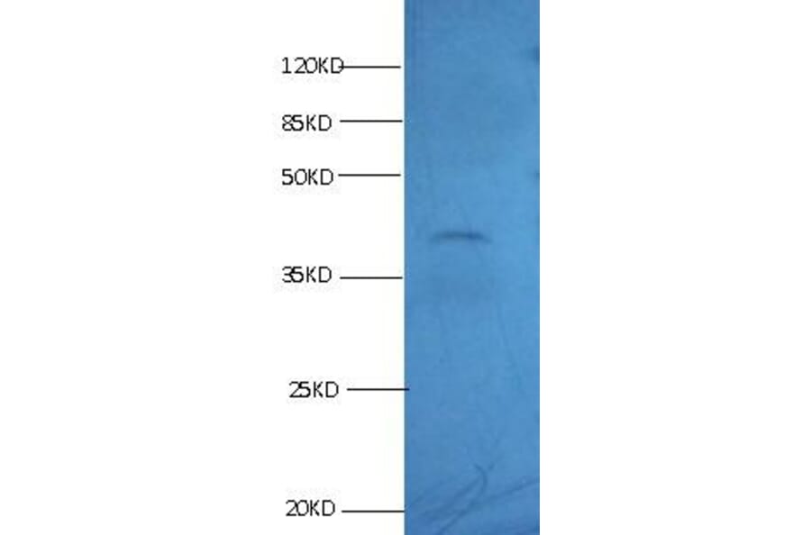 KS19.1 Monoclonal Antibody from Signalway Antibody (42022) - Antibodies.com