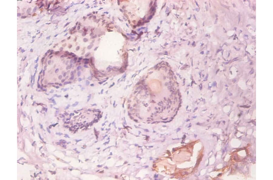 Immunohistochemistry - KS19.1 Monoclonal Antibody from Signalway Antibody (42022) - Antibodies.com