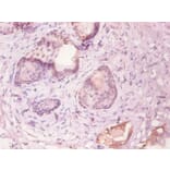 Immunohistochemistry - KS19.1 Monoclonal Antibody from Signalway Antibody (42022) - Antibodies.com