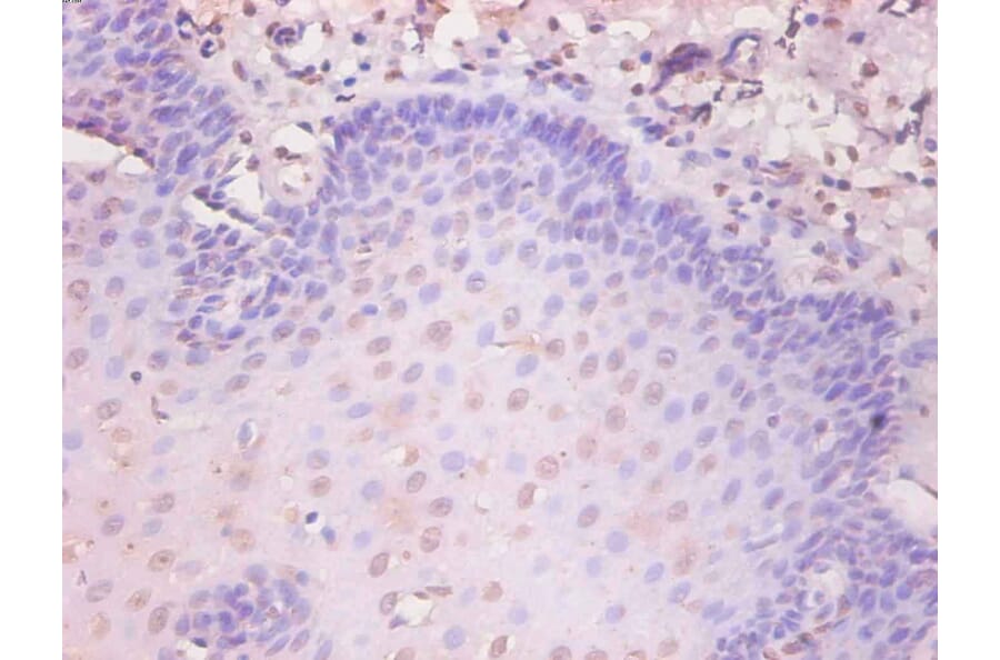 Immunohistochemistry - KS19.1 Monoclonal Antibody from Signalway Antibody (42022) - Antibodies.com