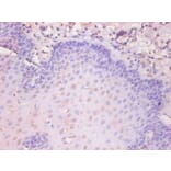 Immunohistochemistry - KS19.1 Monoclonal Antibody from Signalway Antibody (42022) - Antibodies.com
