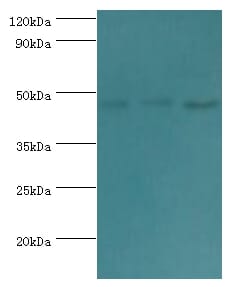 All lanes: Actin-like protein 6B antibody at 3ug/ml. Lane 1: Hela whole cell lysate. Lane 2: U251 whole cell lysate. Lane 3: HepG2 whole cell lysate. Secondary Goat polyclonal to rabbit at 1/10000 dilution predicted band size: 47kDaobserved band size: 47kDa