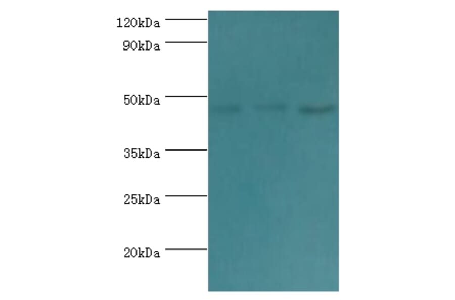 ACTL6B Polyclonal Antibody from Signalway Antibody (42057) - Antibodies.com