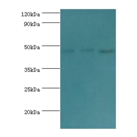 ACTL6B Polyclonal Antibody from Signalway Antibody (42057) - Antibodies.com