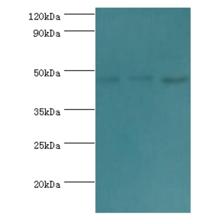 ACTL6B Polyclonal Antibody from Signalway Antibody (42057) - Antibodies.com