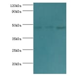 ACTL6B Polyclonal Antibody from Signalway Antibody (42057) - Antibodies.com