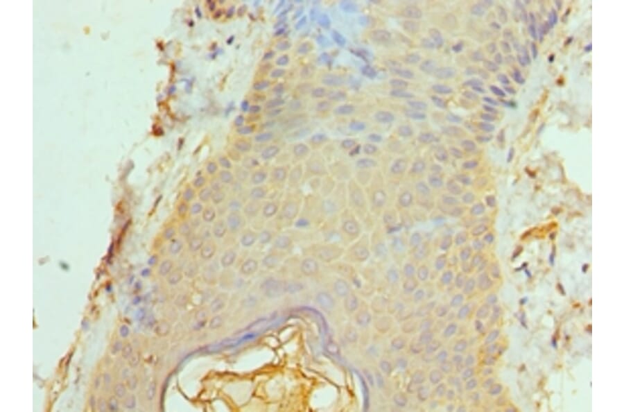 Immunohistochemistry - ACTL6B Polyclonal Antibody from Signalway Antibody (42057) - Antibodies.com