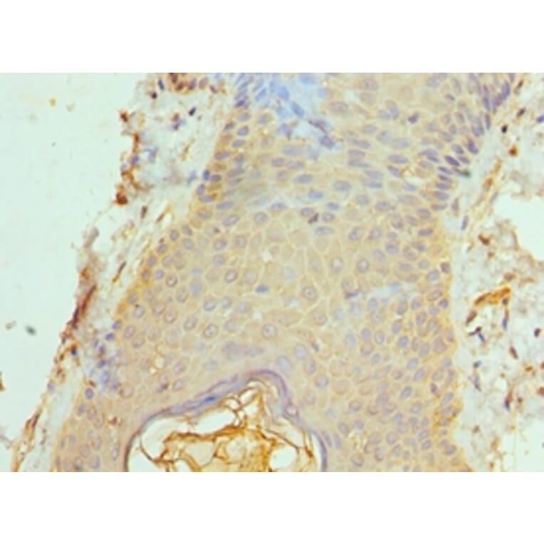 Immunohistochemistry - ACTL6B Polyclonal Antibody from Signalway Antibody (42057) - Antibodies.com