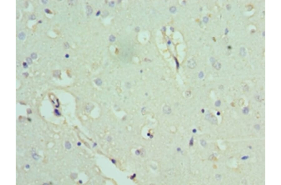 Immunohistochemistry - ACTL6B Polyclonal Antibody from Signalway Antibody (42057) - Antibodies.com