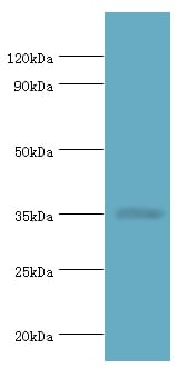 All lanes: DNA repair protein RAD51 homolog 4 antibody at 8ug/ml+Jurkat whole cell lysate. Secondary Goat polyclonal to rabbit at 1/10000 dilution predicted band size: 35kDaobserved band size: 35kDa