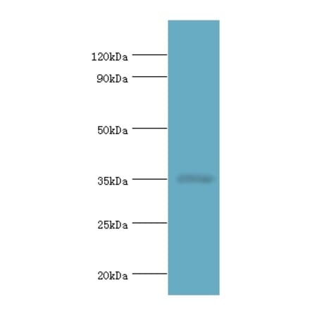 RAD51D Polyclonal Antibody from Signalway Antibody (42306) - Antibodies.com