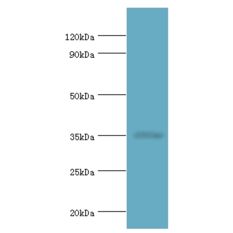 RAD51D Polyclonal Antibody from Signalway Antibody (42306) - Antibodies.com