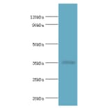 RAD51D Polyclonal Antibody from Signalway Antibody (42306) - Antibodies.com