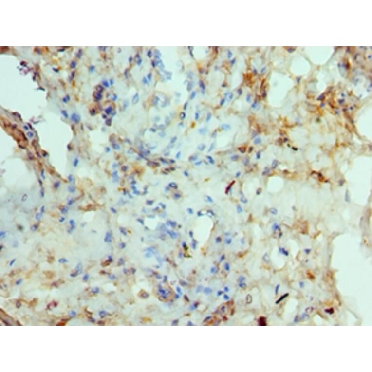Immunohistochemistry - RAD51D Polyclonal Antibody from Signalway Antibody (42306) - Antibodies.com