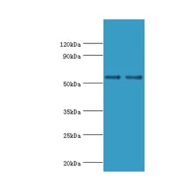 SLC2A1 Polyclonal Antibody from Signalway Antibody (42323) - Antibodies.com