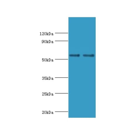 SLC2A1 Polyclonal Antibody from Signalway Antibody (42323) - Antibodies.com