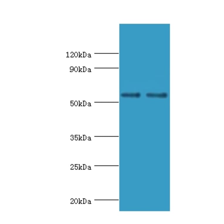 SLC2A1 Polyclonal Antibody from Signalway Antibody (42323) - Antibodies.com