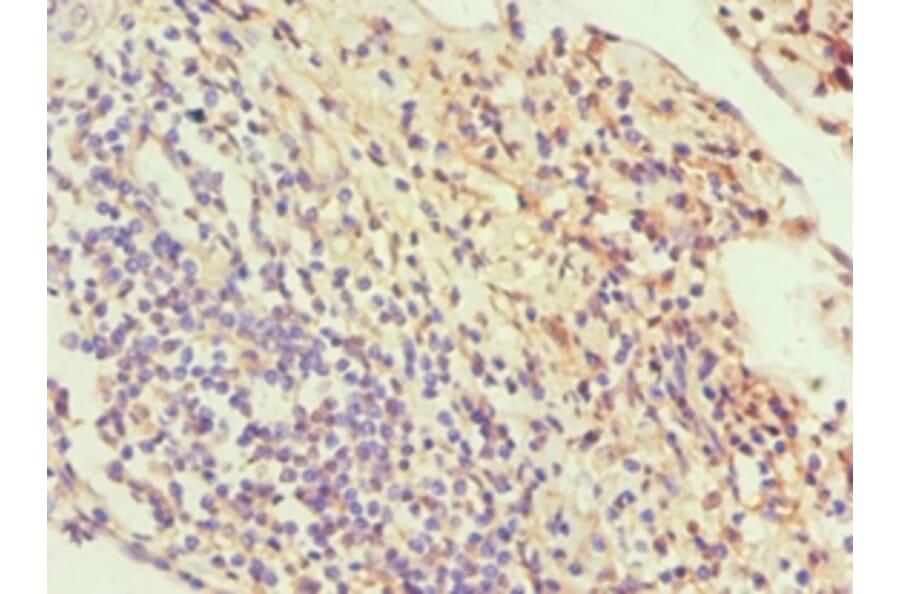 Immunohistochemistry - SLC2A1 Polyclonal Antibody from Signalway Antibody (42323) - Antibodies.com