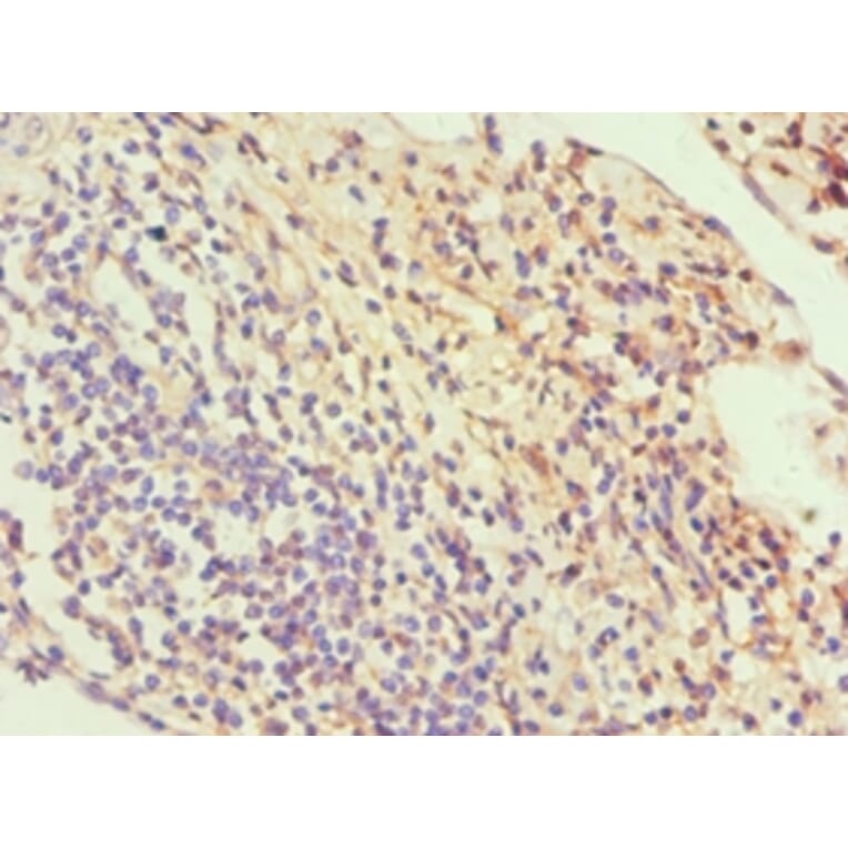 Immunohistochemistry - SLC2A1 Polyclonal Antibody from Signalway Antibody (42323) - Antibodies.com