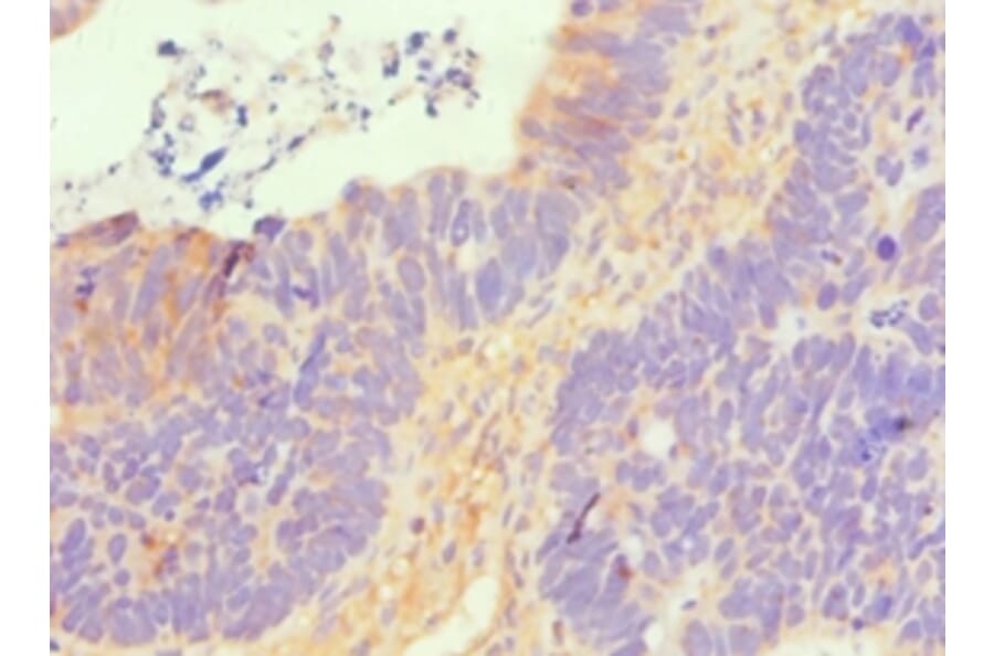 Immunohistochemistry - SLC2A1 Polyclonal Antibody from Signalway Antibody (42323) - Antibodies.com