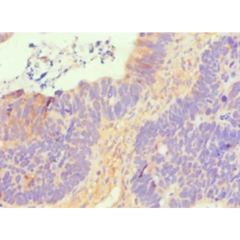 Immunohistochemistry - SLC2A1 Polyclonal Antibody from Signalway Antibody (42323) - Antibodies.com