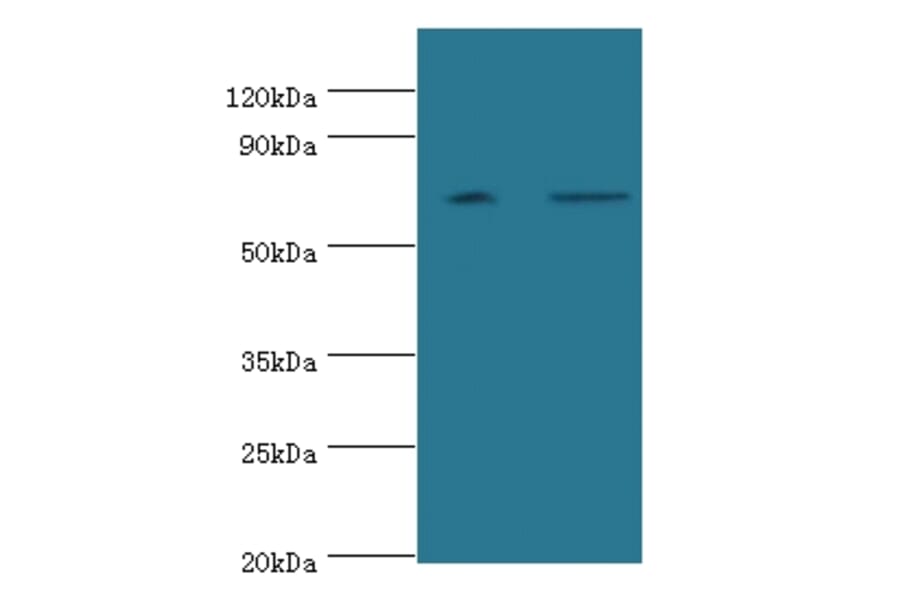 Poly (A)-specific ribonuclease PARN Polyclonal Antibody from Signalway Antibody (42286) - Antibodies.com