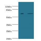 Poly (A)-specific ribonuclease PARN Polyclonal Antibody from Signalway Antibody (42286) - Antibodies.com