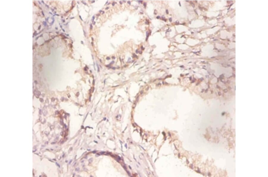 Immunohistochemistry - Poly (A)-specific ribonuclease PARN Polyclonal Antibody from Signalway Antibody (42286)