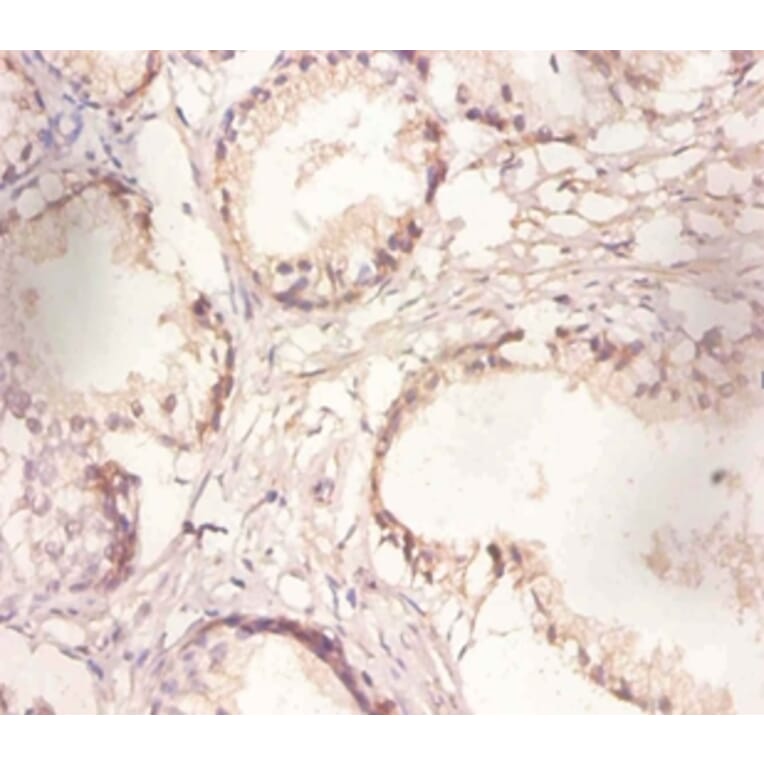 Immunohistochemistry - Poly (A)-specific ribonuclease PARN Polyclonal Antibody from Signalway Antibody (42286)