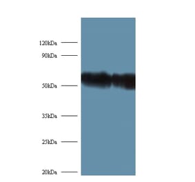 Ribosomal protein S6 kinase beta-2 Polyclonal Antibody from Signalway Antibody (42378) - Antibodies.com