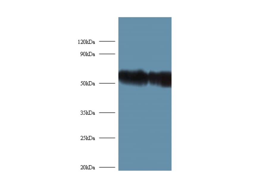 Ribosomal protein S6 kinase beta-2 Polyclonal Antibody from Signalway Antibody (42378) - Antibodies.com