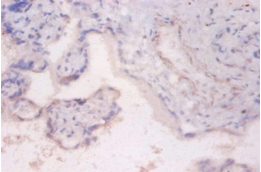Immunohistochemistry - Ribosomal protein S6 kinase beta-2 Polyclonal Antibody from Signalway Antibody (42378)