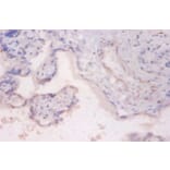 Immunohistochemistry - Ribosomal protein S6 kinase beta-2 Polyclonal Antibody from Signalway Antibody (42378)