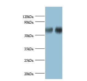 D-3-phosphoglycerate dehydrogenase Polyclonal Antibody from Signalway Antibody (42388) - Antibodies.com