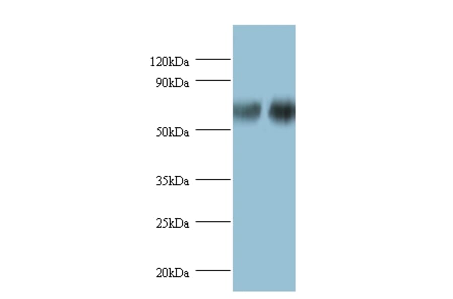 D-3-phosphoglycerate dehydrogenase Polyclonal Antibody from Signalway Antibody (42388) - Antibodies.com