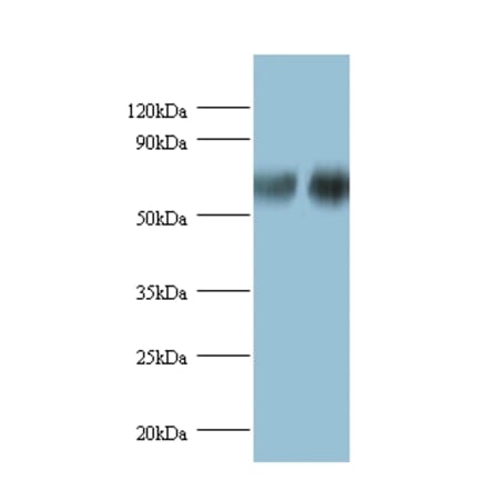 D-3-phosphoglycerate dehydrogenase Polyclonal Antibody from Signalway Antibody (42388) - Antibodies.com