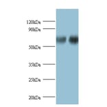 D-3-phosphoglycerate dehydrogenase Polyclonal Antibody from Signalway Antibody (42388) - Antibodies.com