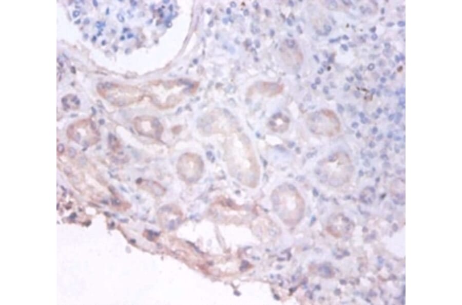 Immunohistochemistry - D-3-phosphoglycerate dehydrogenase Polyclonal Antibody from Signalway Antibody (42388)