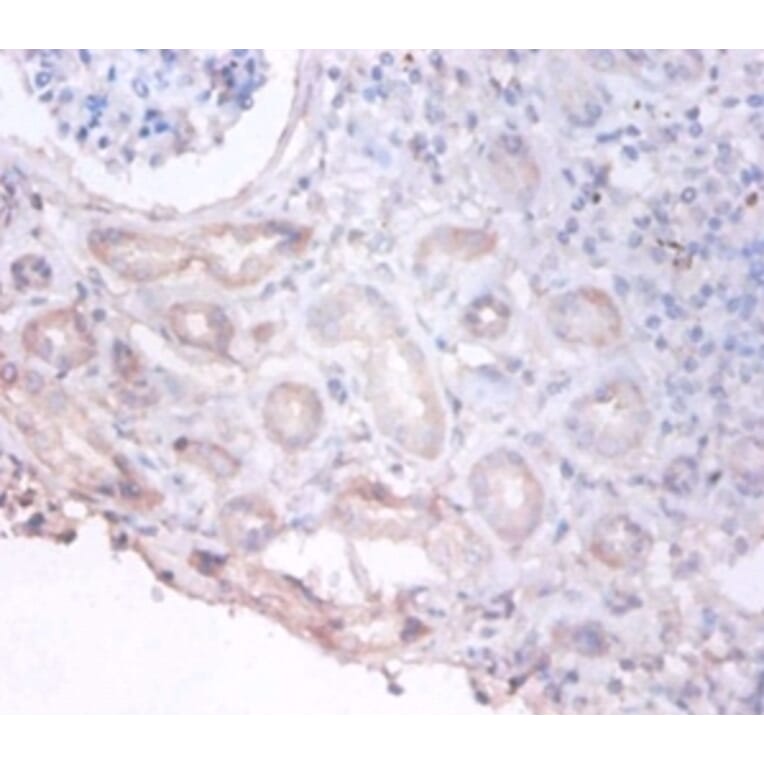 Immunohistochemistry - D-3-phosphoglycerate dehydrogenase Polyclonal Antibody from Signalway Antibody (42388)