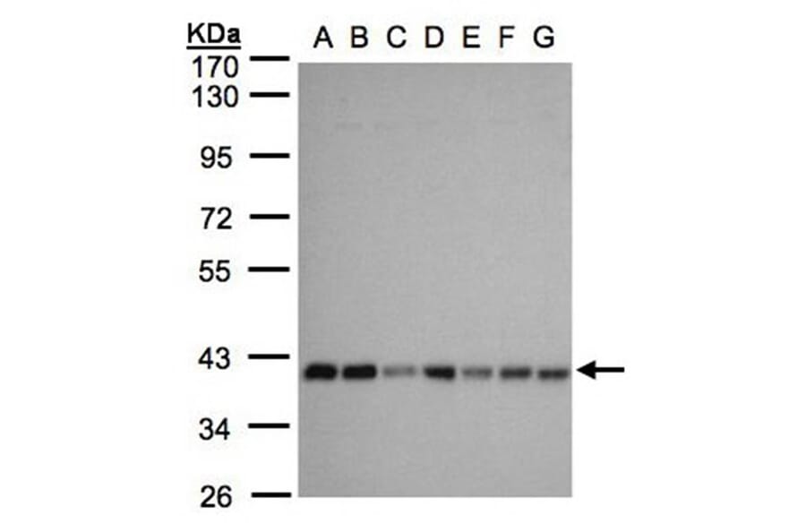mitochondrial carrier protein MGC4399 antibody from Signalway Antibody (23159) - Antibodies.com