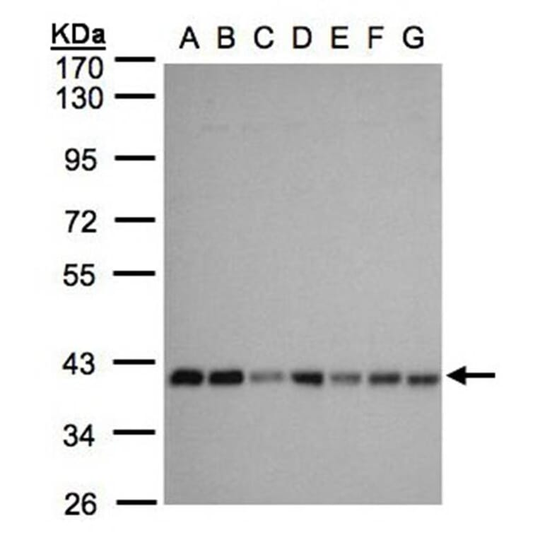 mitochondrial carrier protein MGC4399 antibody from Signalway Antibody (23159) - Antibodies.com