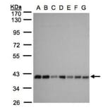 mitochondrial carrier protein MGC4399 antibody from Signalway Antibody (23159) - Antibodies.com