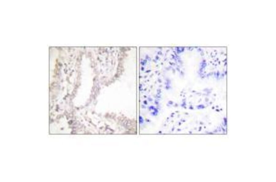 Immunohistochemistry - Prostate Apoptosis Response Protein-4 Antibody from Signalway Antibody - Antibodies.com