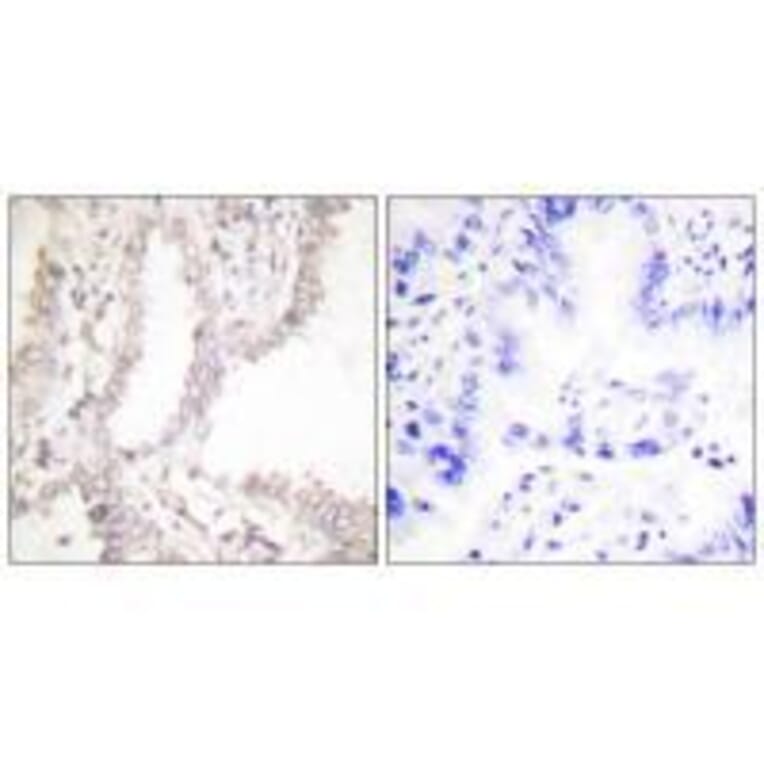 Immunohistochemistry - Prostate Apoptosis Response Protein-4 Antibody from Signalway Antibody - Antibodies.com